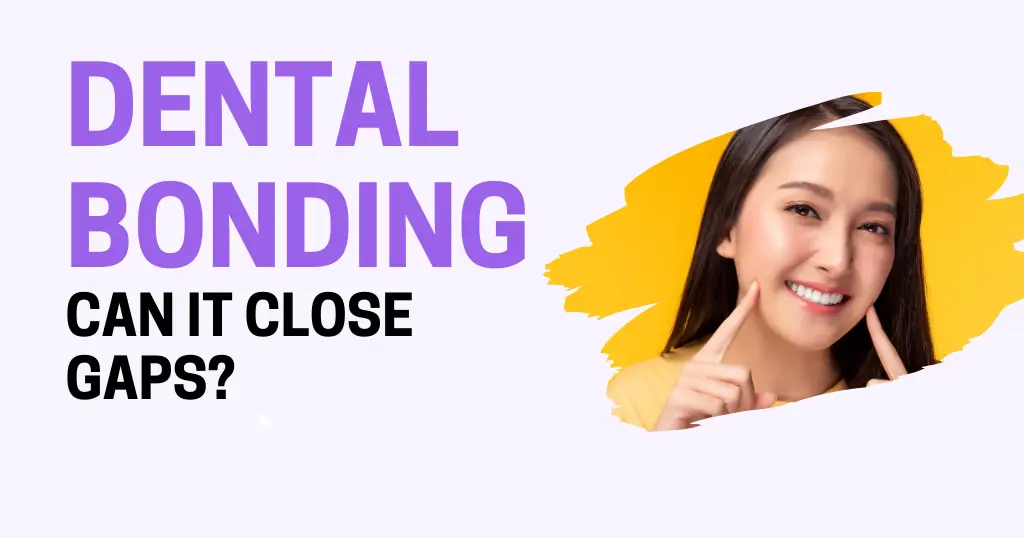 Can Dental Bonding Close Gaps in Hazen Teeth?