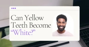 Whitening Yellow Teeth Blog Header