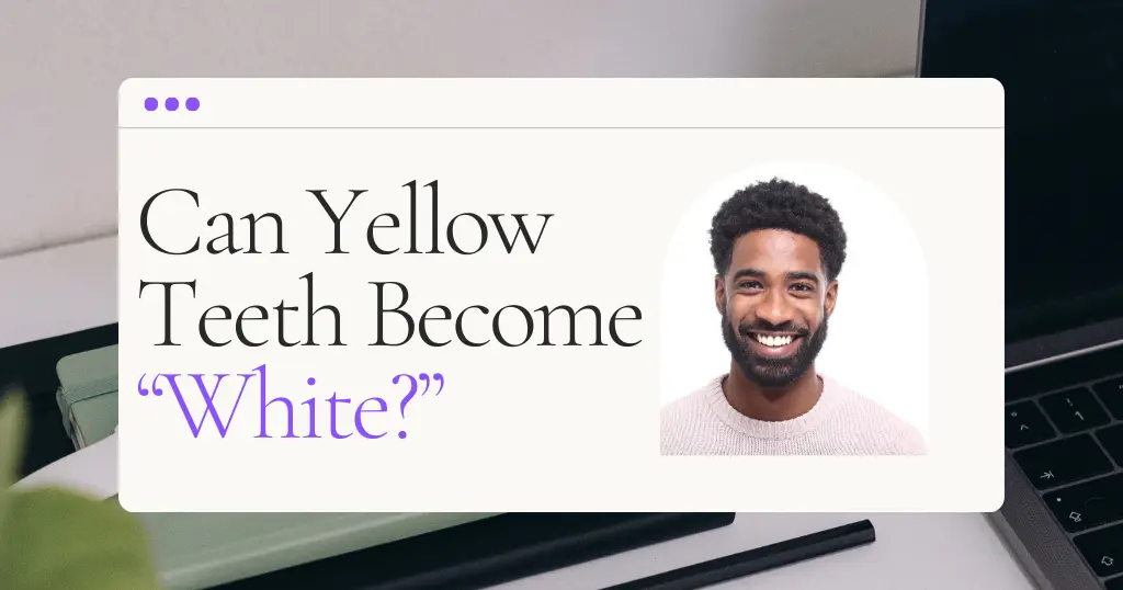Can Yellow Teeth Become White Again In Hazen?