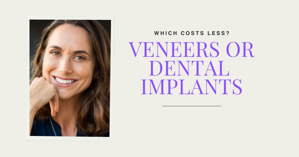 Are Veneers Less Expensive Than Implants In Hazen?