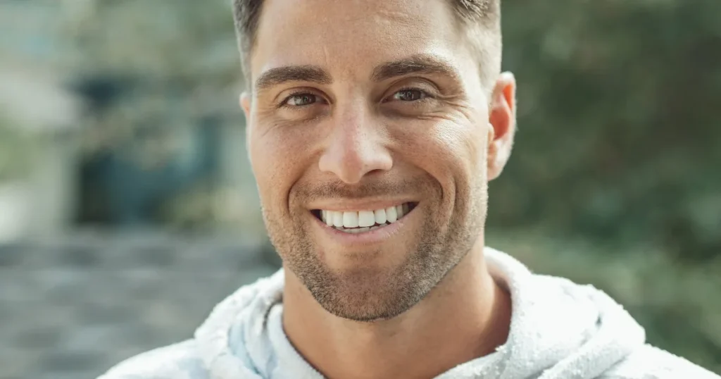 Man Confident Smile Dental Veneers